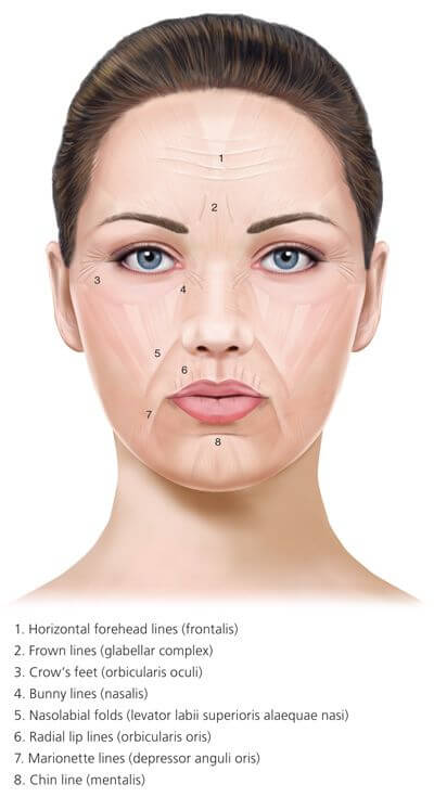 56bda8eed09a136edcf0d32dfbe08f82 Botox Training Botulinum Toxin