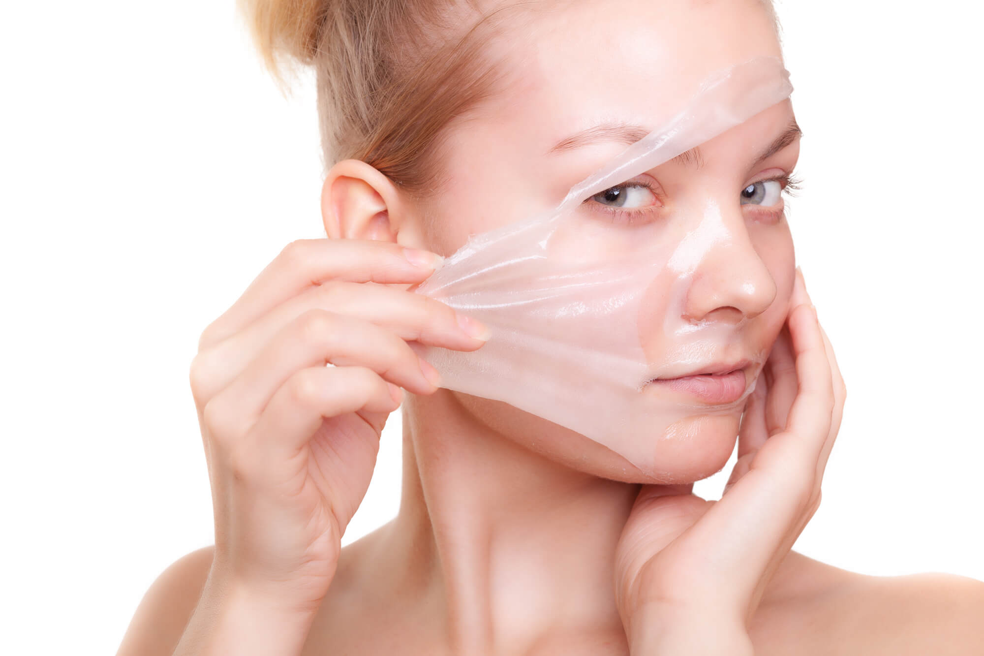 5 Effective Treatment Options for Freckles