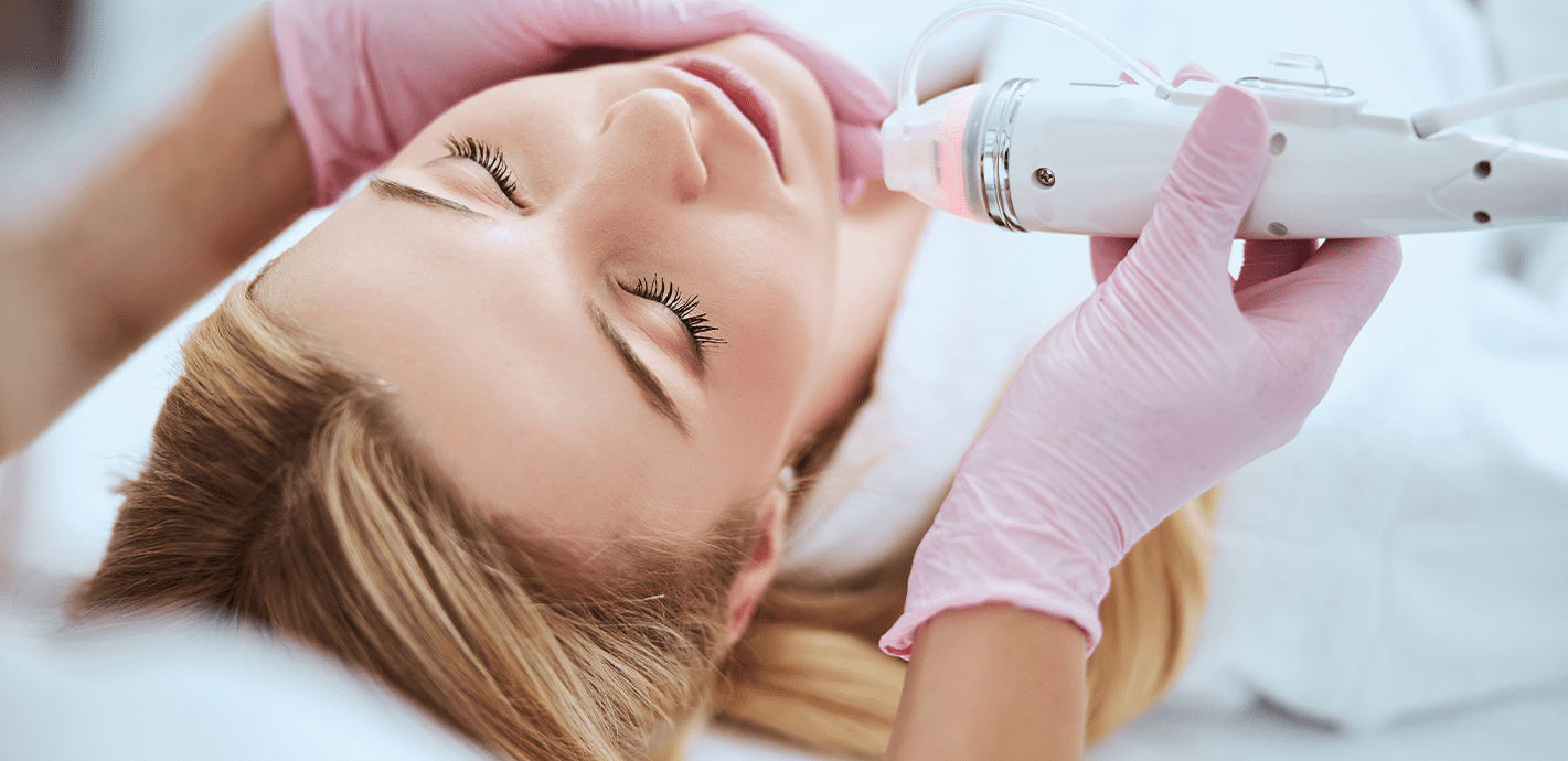 Microneedling