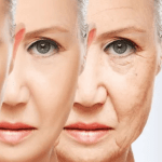 The Truth About Skin Tightening What Really Works