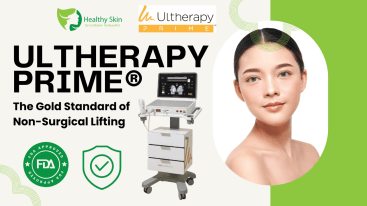Ultherapy (1)