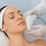 Radiofrequency and Ultrasound Treatments Skin Tightening without Procedure