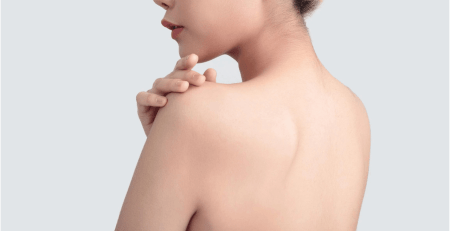 Get Clear Back Skin The Ultimate Guide